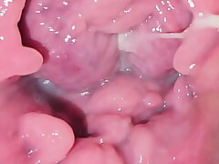 Investigating my vulva