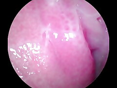 Camera deep inwards of the raw vagina and captured the powerful nymph orgasm!!