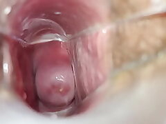 Speculum inwards labia