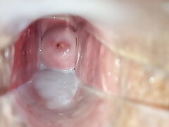 #Cum inside snatch close-up speculum#